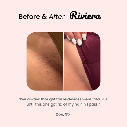 Riviera Bikini Shaver 2.0