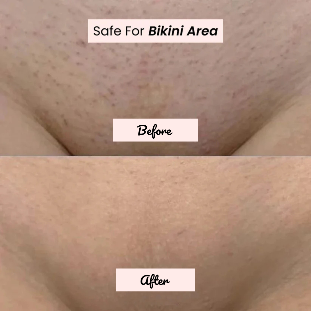 Riviera Bikini Shaver 2.0