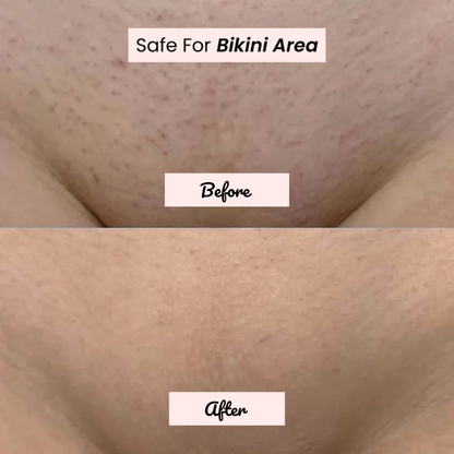 Riviera Bikini Shaver 2.0