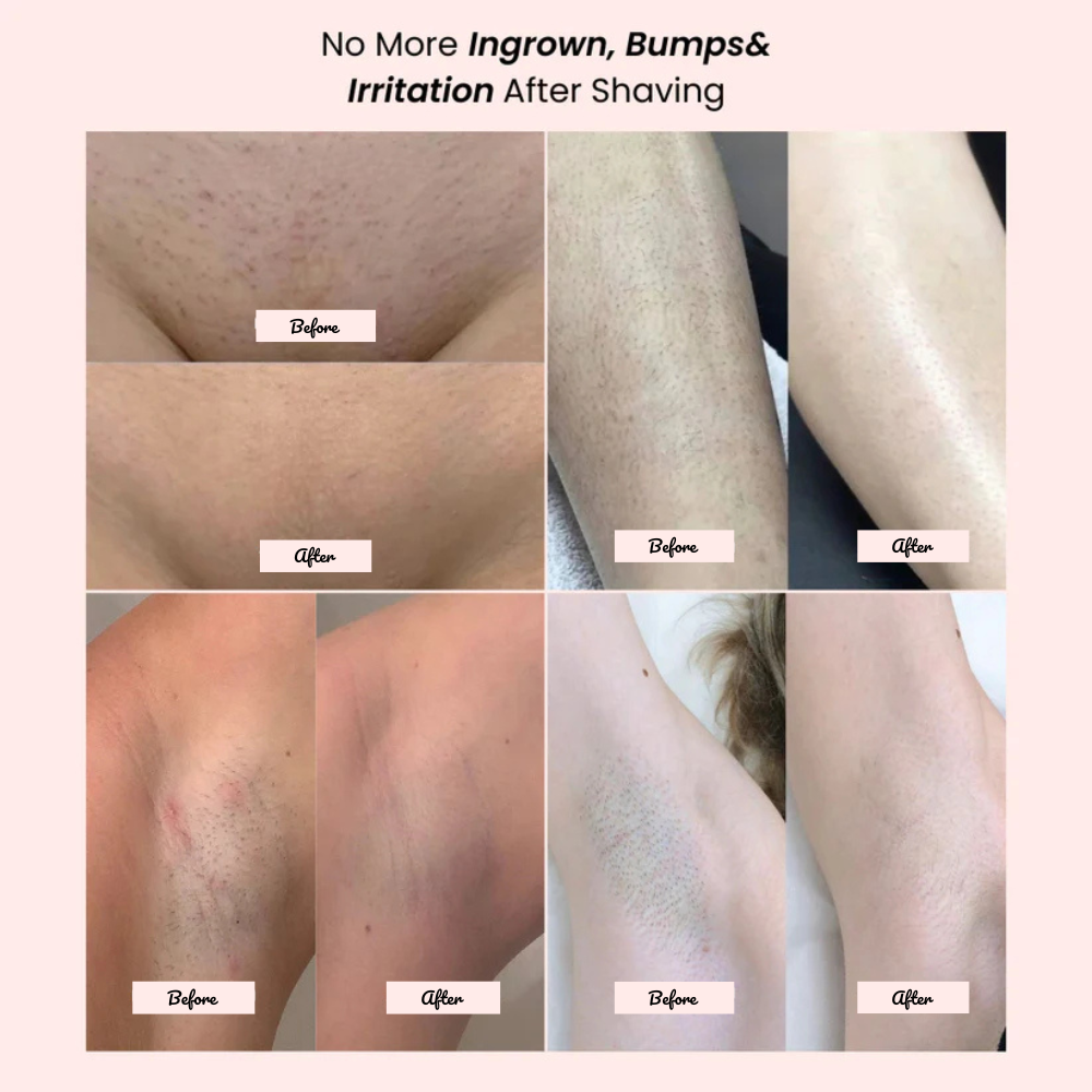 Riviera Bikini Shaver 2.0