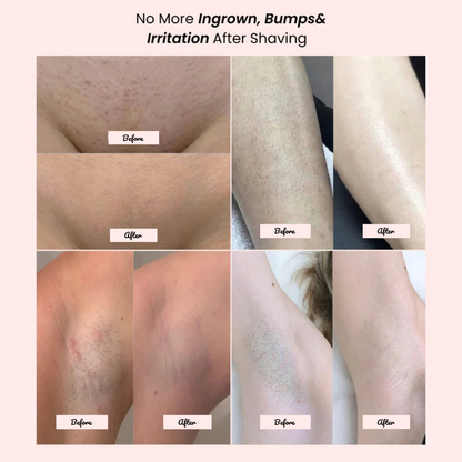 Riviera Bikini Shaver 2.0