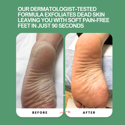 Instant Foot Peeling Spray